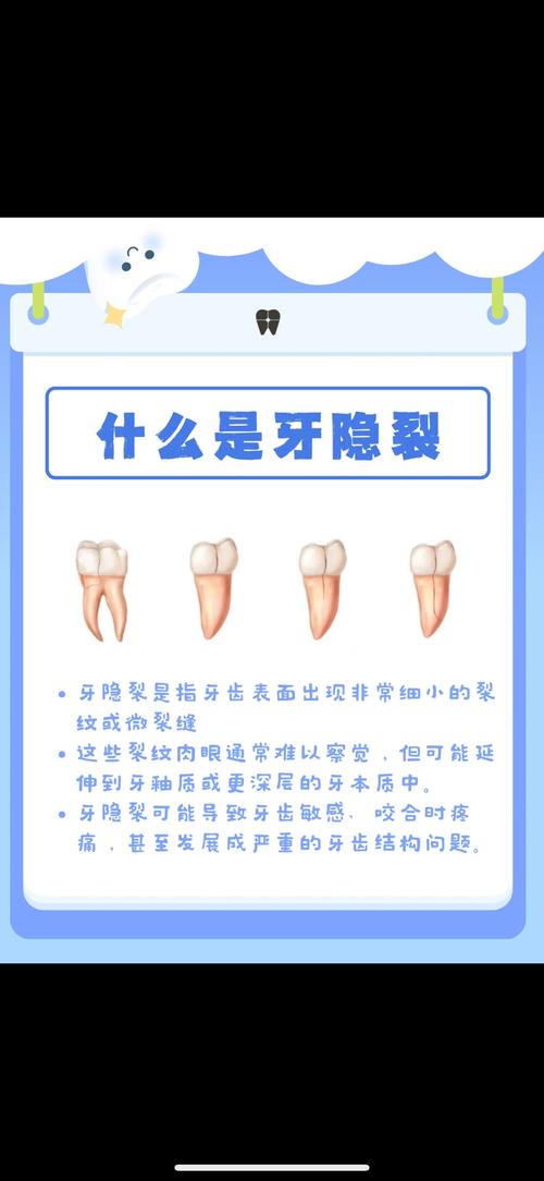 风湿类风湿会影响牙齿吗