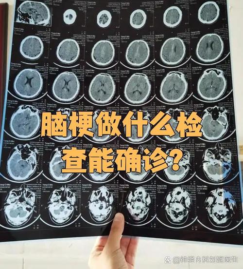 脑梗做脑彩超还是脑ct