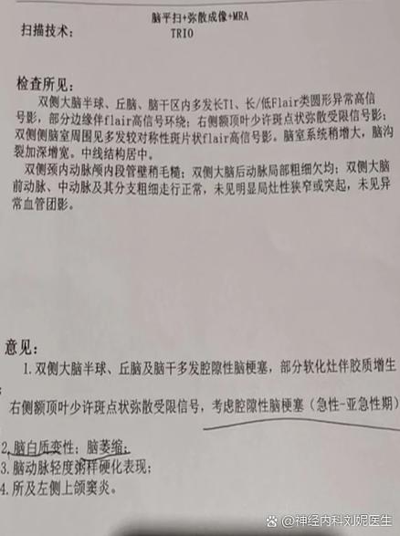 脑CT结果提示可疑脑梗