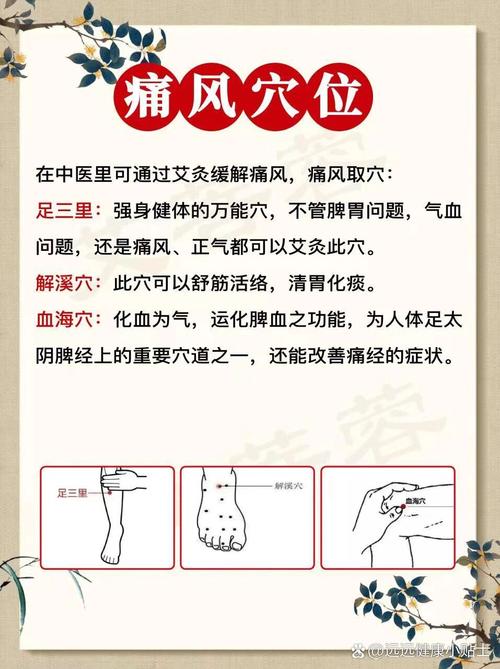 痛风急性发作艾灸穴位