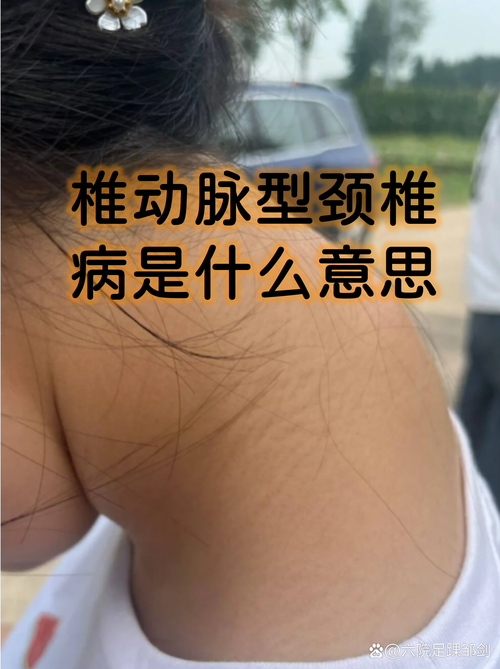 脑梗颈椎病能导致脑梗吗