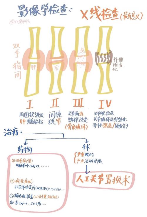 产后类风湿和普通类风湿