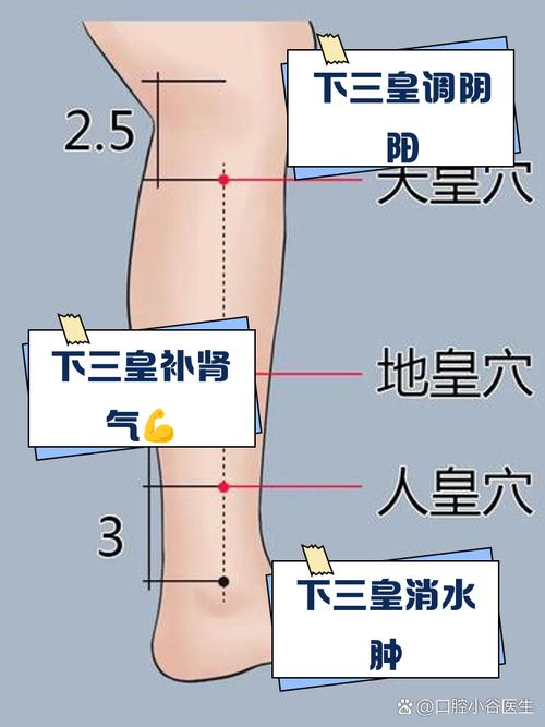 下风湿点 下风湿下点穴