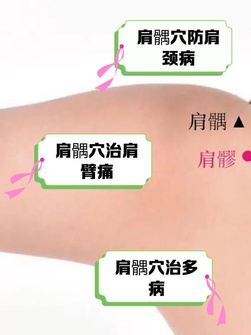 肩周炎止痛按摩穴位图