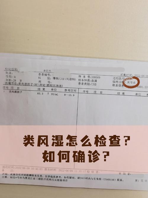 检测风湿类风湿要空腹吗