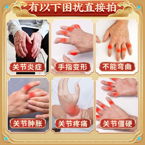 手关节有风湿类风湿西药