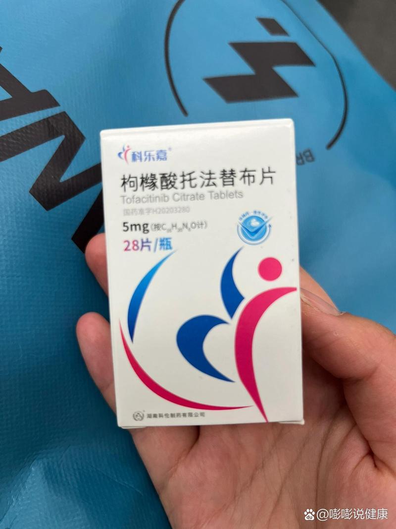 手关节有风湿类风湿西药