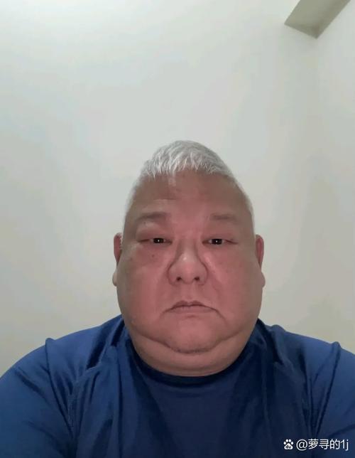 45岁男脑梗大面积脑梗