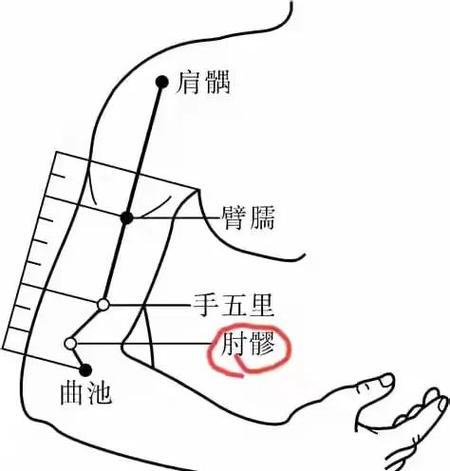 手臂麻木针灸什么穴位