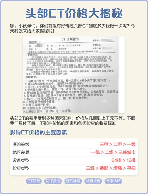 上海 脑ct价格 脑梗