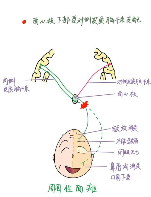 中枢性脑梗和周围性脑梗