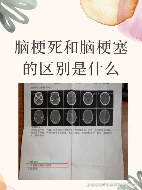 急性脑梗与慢性脑梗区别