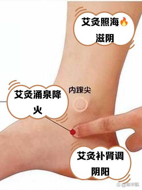 艾灸那些穴位治疗早泄