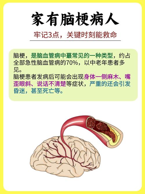 陈旧脑梗与新发脑梗区别