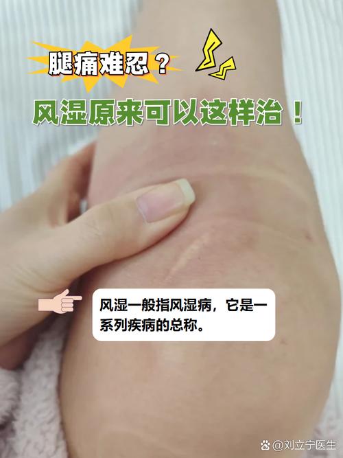 风湿类风湿有图片看看吗