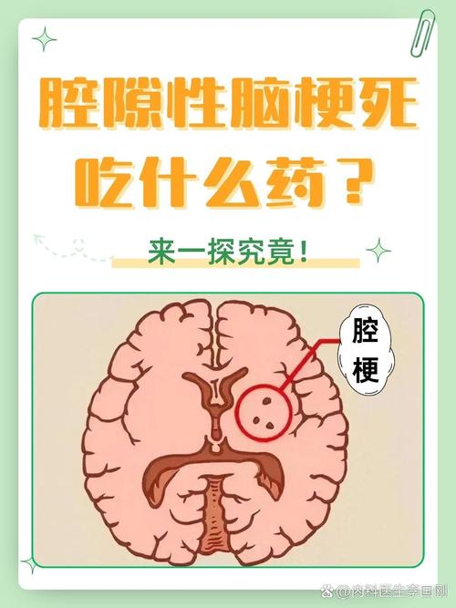 脑腔梗是怎么回事严重吗
