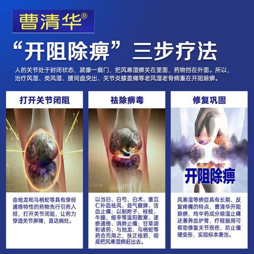 曹清华风湿治疗类风湿吗