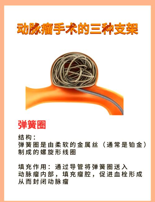 脑梗做支架的利弊有哪些