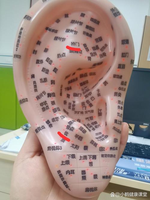 耳朵对折顶端穴位针刺