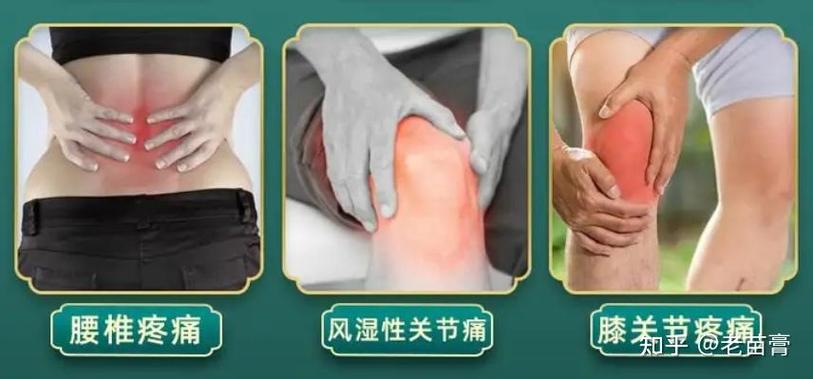 月子风湿类风湿治疗好吗