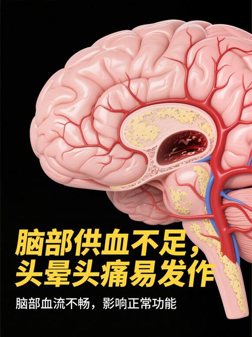 脑供血不足会发生脑梗吗
