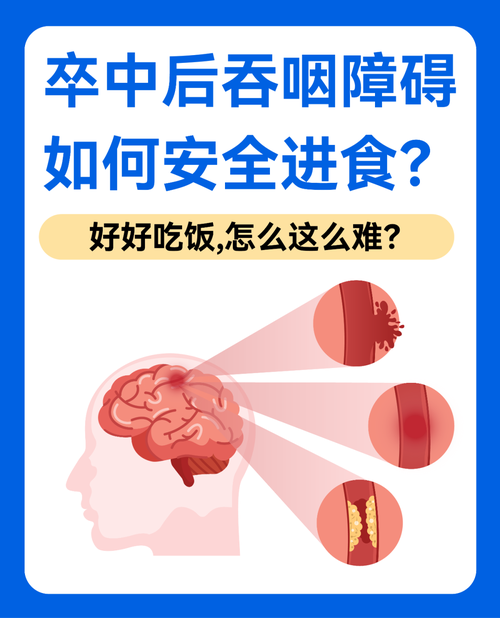 脑梗病人吃东西呛怎么办