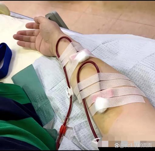 脑梗溶血针6000一针