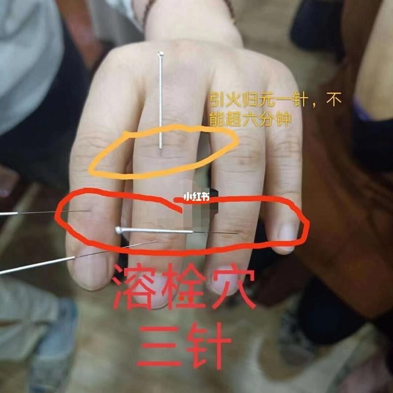 脑梗溶血针6000一针