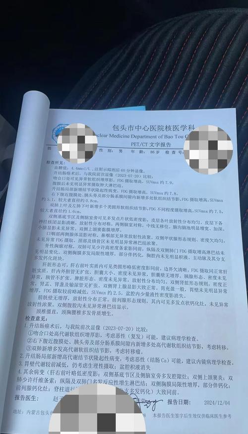 依达拉奉治疗脑梗怎么样