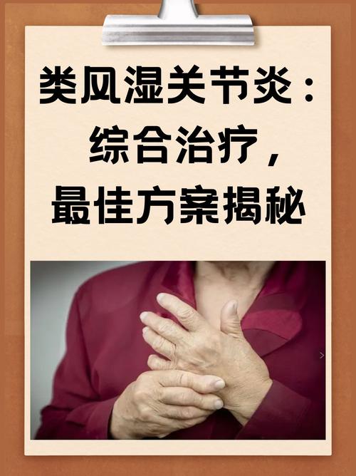 风湿类风湿治疗那家好点