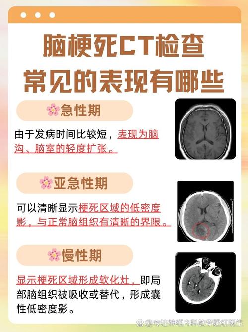 脑梗病人肺部炎症症状