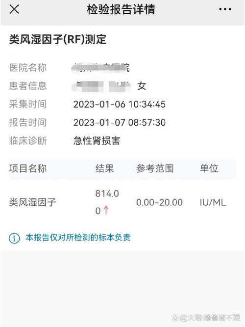风湿因子阴性就没有风湿