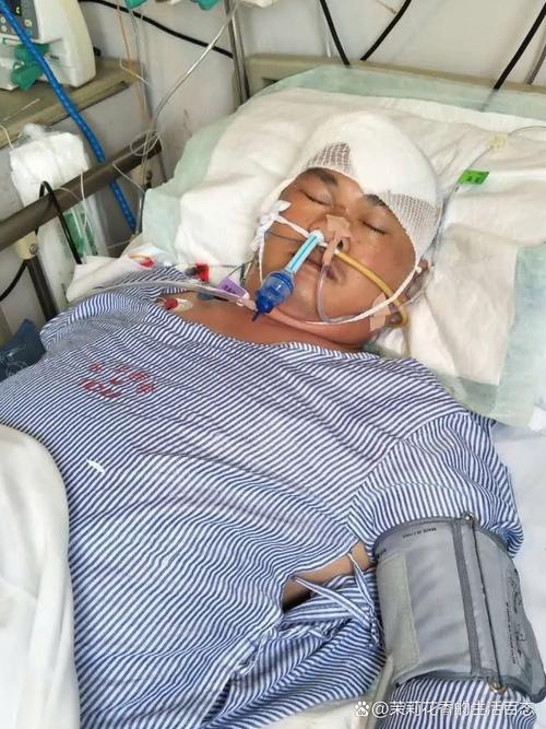 脑梗开颅手术进ICU