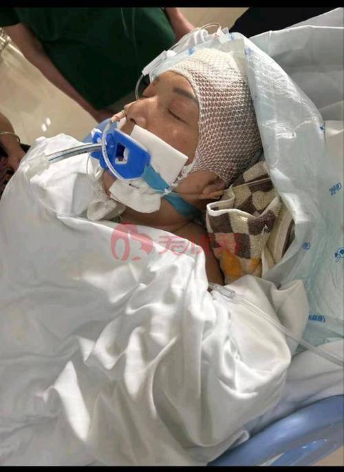 脑梗开颅手术进ICU