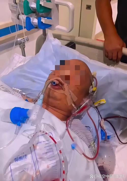 北京301总医院脑梗