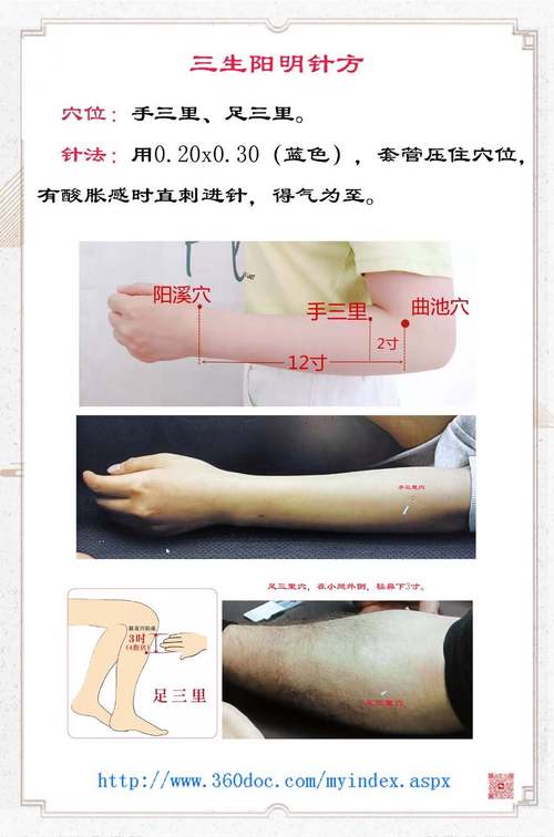 类风湿性关节炎针灸治疗