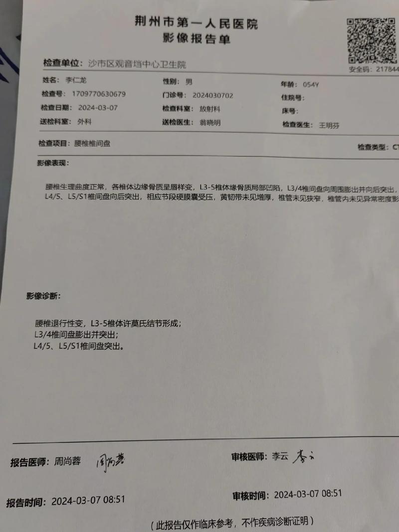 类风湿性关节炎专科检查