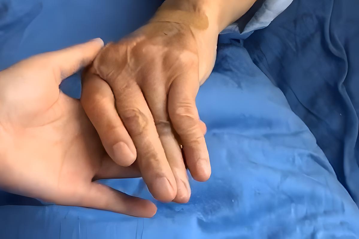 类风湿性关节炎辅助检查