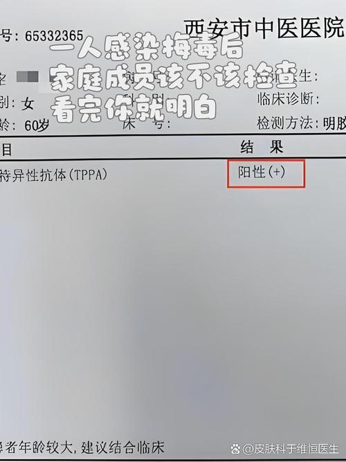 脑梗病人患有梅毒阳性