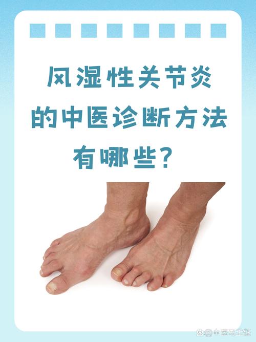 风湿性关节炎属于哪个科