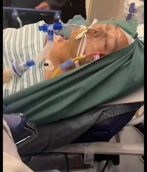 脑梗病人晚上睡觉吐血