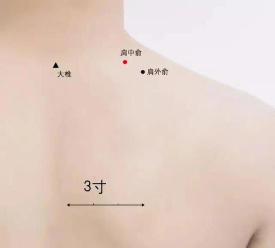 后背疼痛艾灸什么穴位