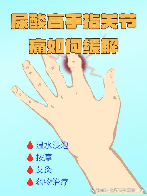 风湿性手关节炎怎么治疗