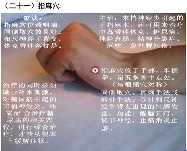 穴位介入平衡修复疗法