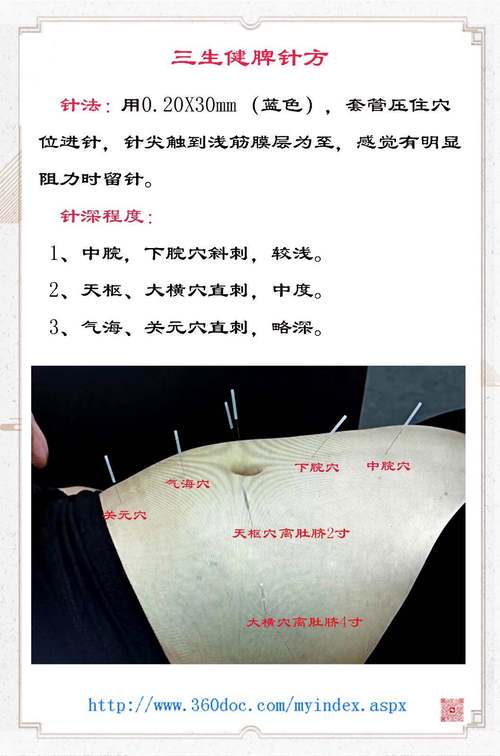 类风湿关节炎怎么样治疗