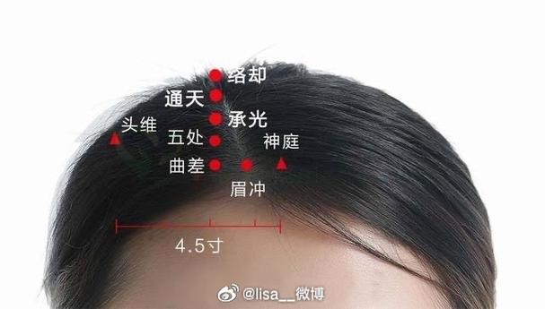 承光穴位区域出现酸疼