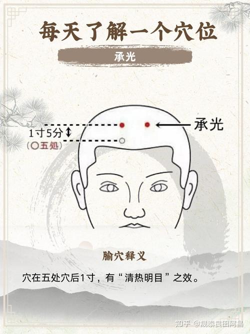 承光穴位区域出现酸疼