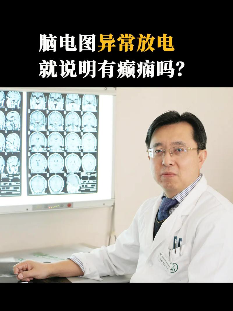 脑电图可以检查脑梗吗