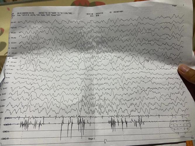 脑电图可以检查脑梗吗