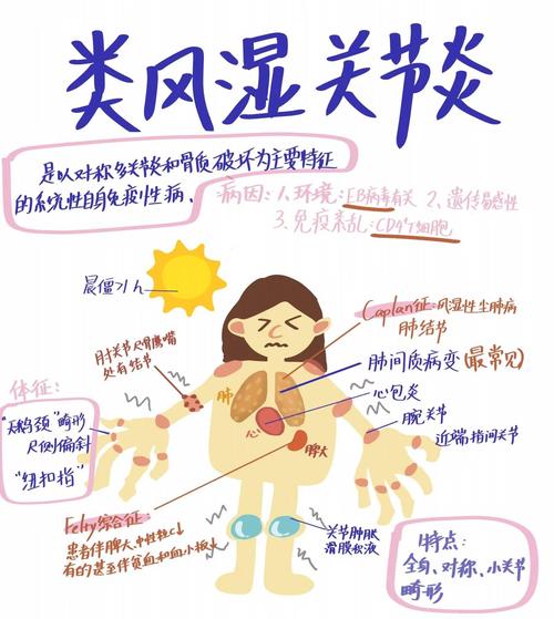 类风湿关节炎的主要表现